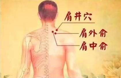 真空拔罐效果一样吗（再次爆红奥运会）(2)