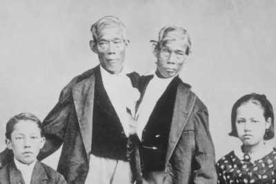 ​感受200年前的怪人秀、畸形秀 揭秘世界上最重口味的穆特博物馆