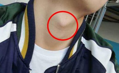 ​亲男生喉结是什么反应 亲男生喉结会起反应吗