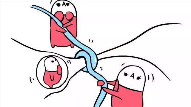 宫外孕一般是什么导致宫外孕的（宫外孕是怎么一回事）(11)