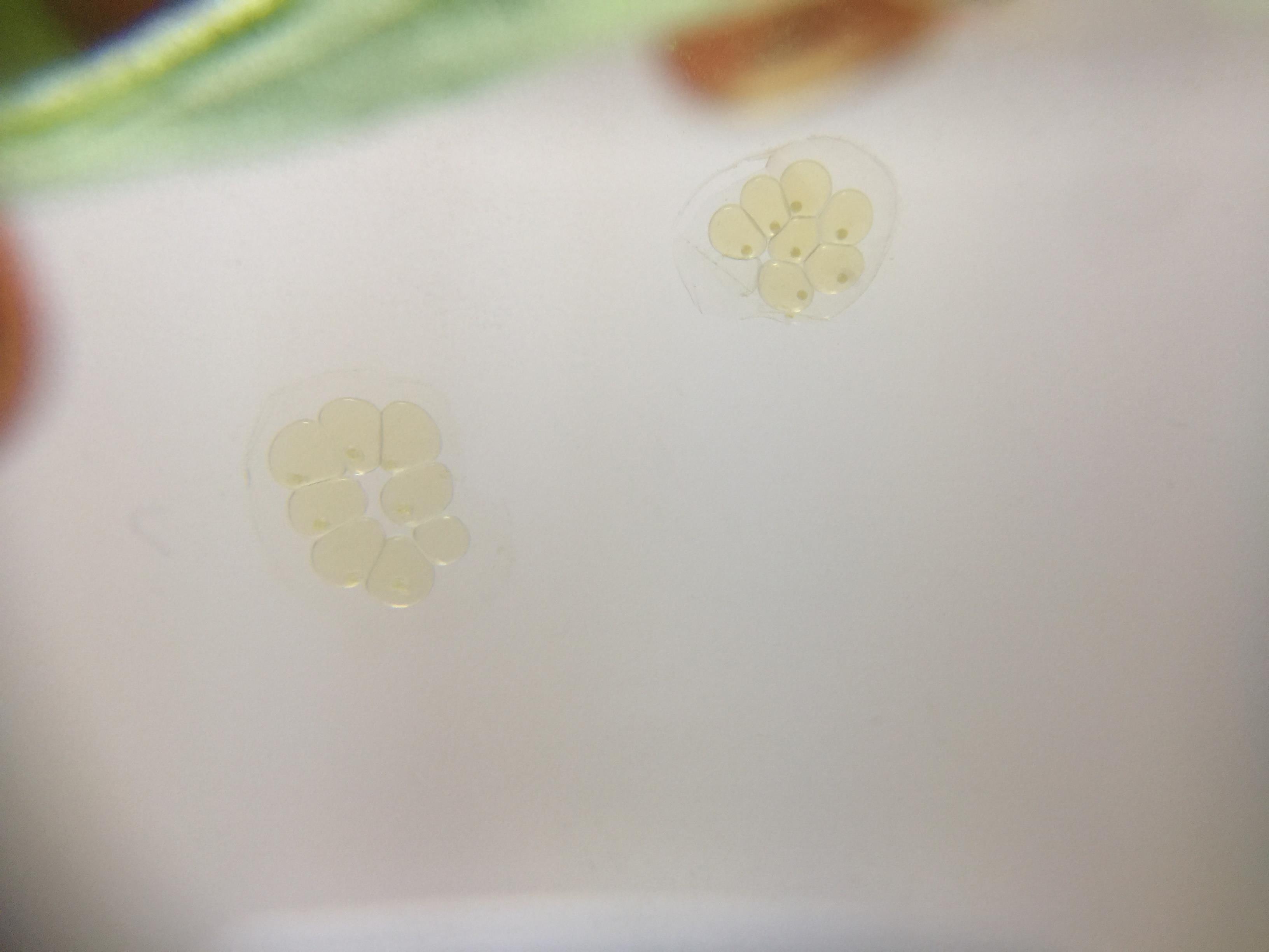 来自南美苹果螺的卵 生命原来是这样诞生的