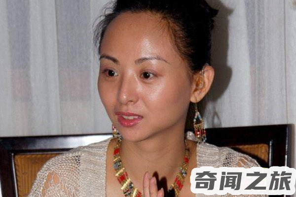 残疾明星有哪些(患上残疾的名人个个才华横溢)(3)_