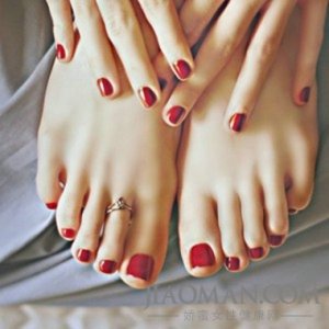 ​冻疮怎么治快速消除 冻疮的治疗方法 13个小方法快速根治冻疮