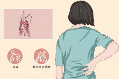​什么是腰肌劳损？常见于哪些部位？该如何预防？