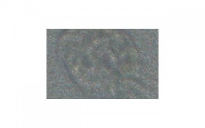 ​男性用户如何解决早泄问题 做深蹲是否能提高性功能