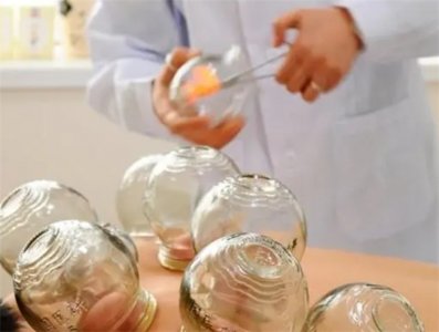 ​拔罐时哪些事项要注意