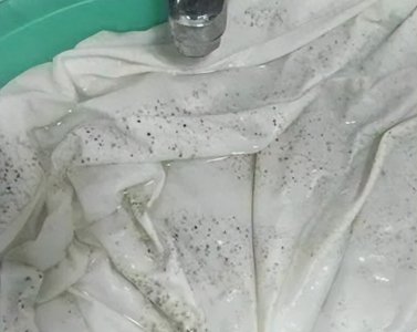 ​衣服上的霉斑可以通过哪种方法去除?