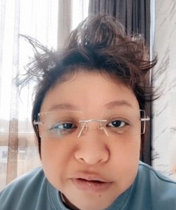 ​51岁韩红感染新冠，头发凌乱神志不清，脸部肿胀有点嘴歪